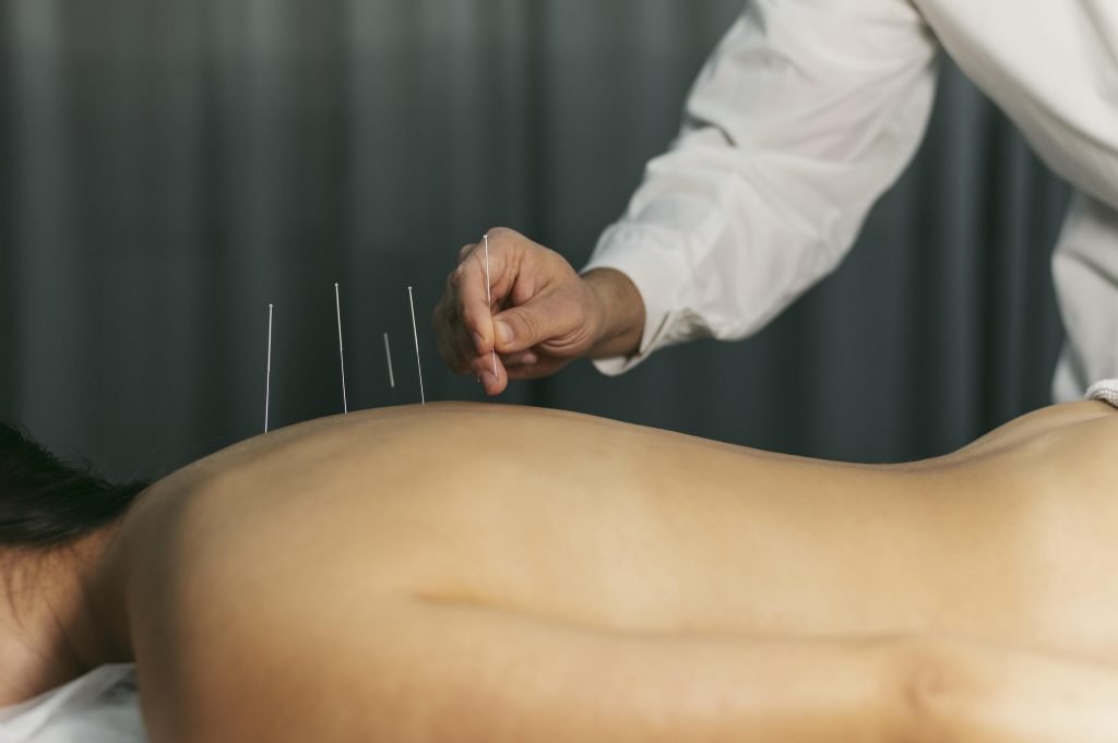 Acupuncturist in Geleen
